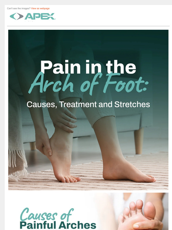 Apex Foot Need relief from arch of foot pain? Milled