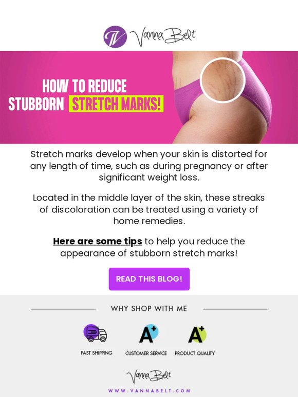[BLOG] How To Reduce Stubborn Stretch Marks!