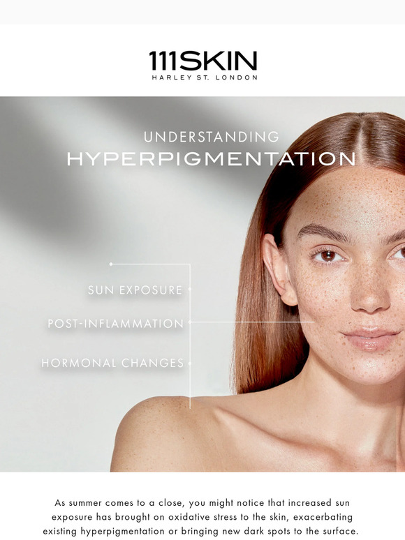 SKIN SOLUTIONS: Hyperpigmentation