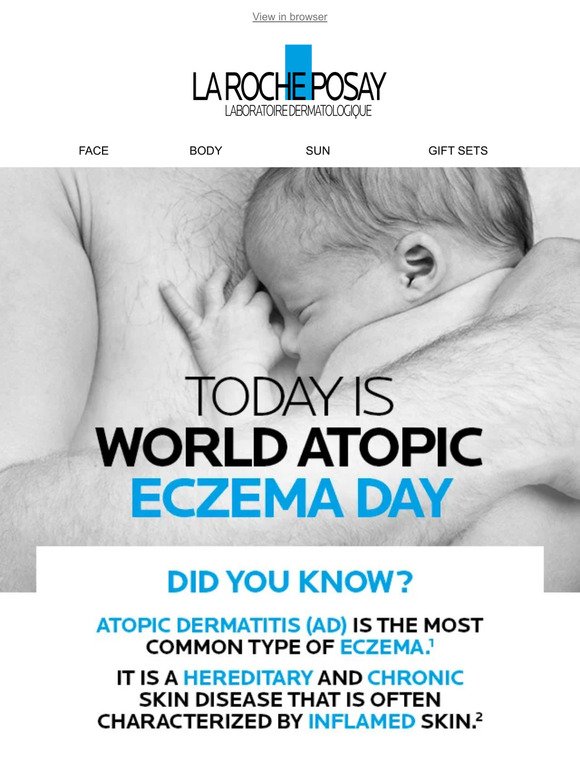 Today Is World Atopic Eczema Day
