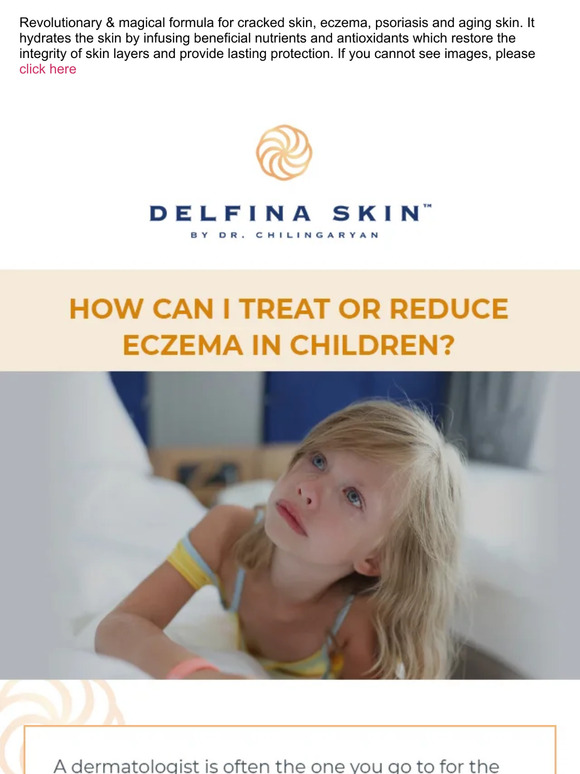 How can i treat or reduce eczema in children?