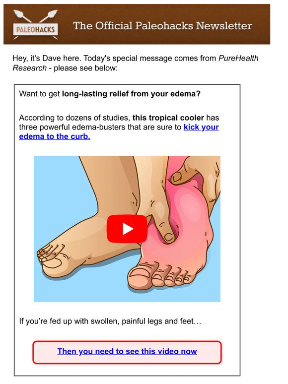 Lymphedema Swelling? Do THIS Daily And See How It Feels