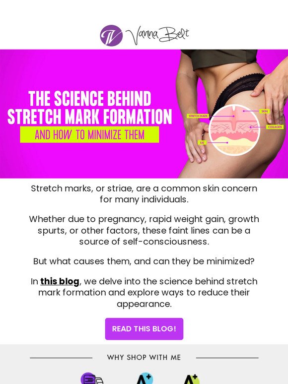 [BLOG] The Science Behind Stretch Mark Formation and How to Minimize Them