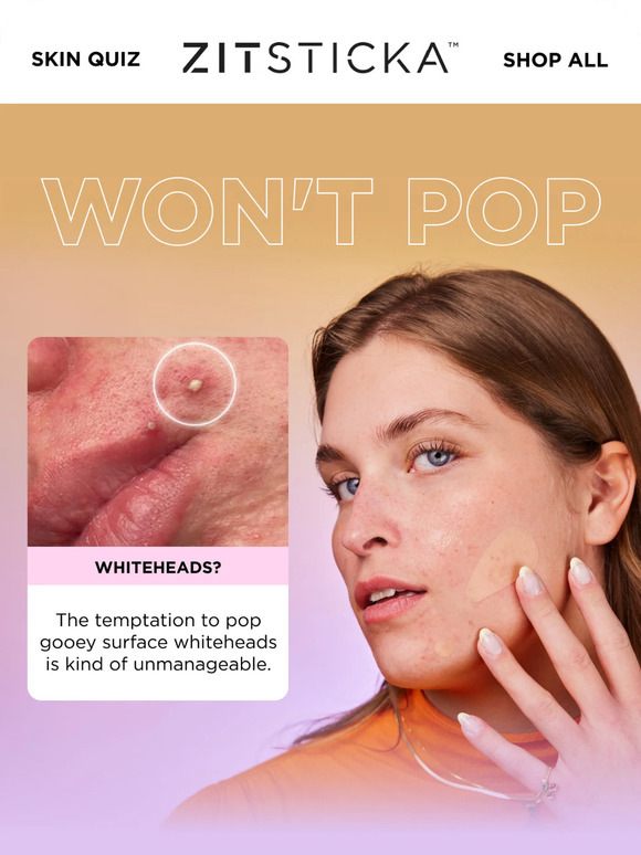 If you're reading this, DON'T POP THAT PIMPLE!