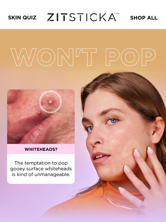 How Hydrocolloid patches work 🧰
