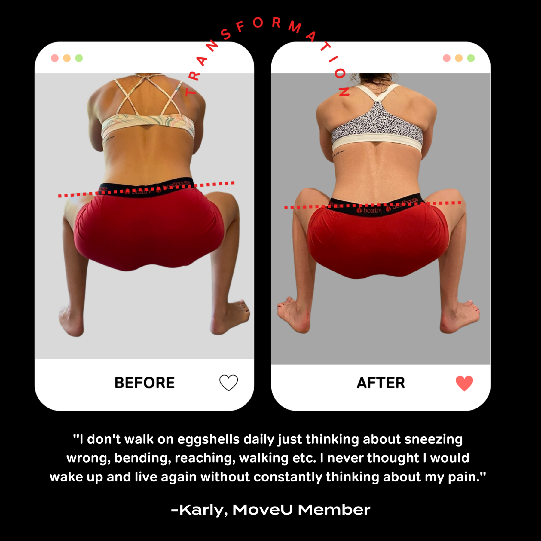 MoveU, Holdings, Inc. What Causes Unequal Leg Lengths? Milled