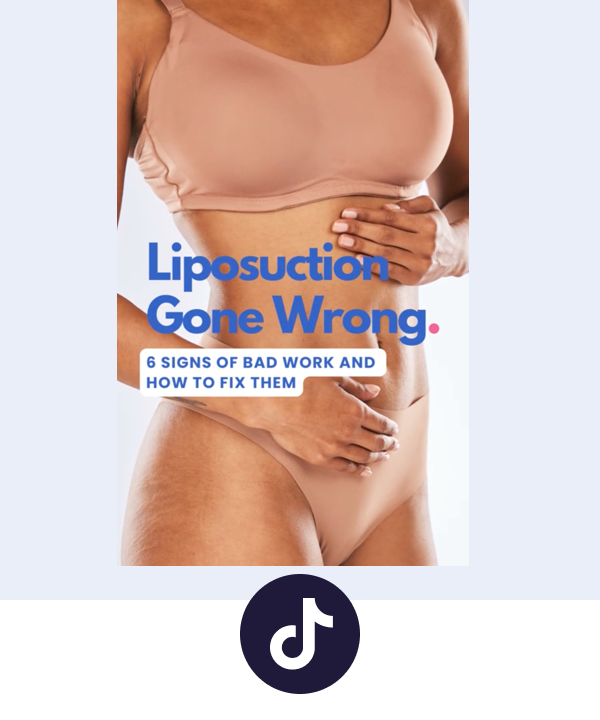Liposuction Gone Wrong