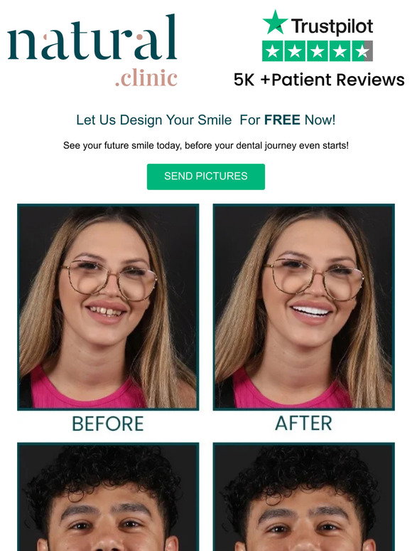 HollySmile by Natural Clinic: Your Smile Design Is Ready, check it NOW ...