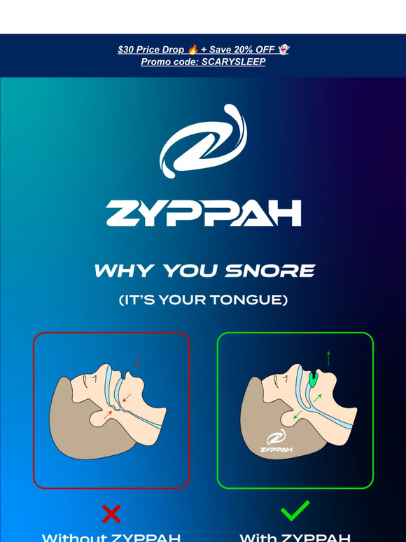 👅❌ | 😊✅ WHY YOU SNORE (It's Your Tongue!)