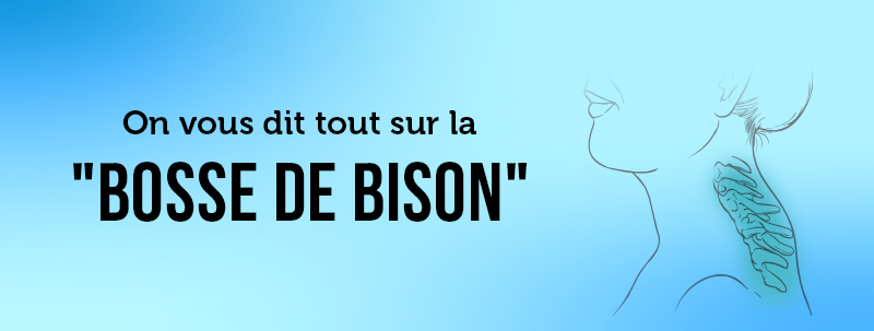 Percko France La bosse de bison Que faire ? Milled