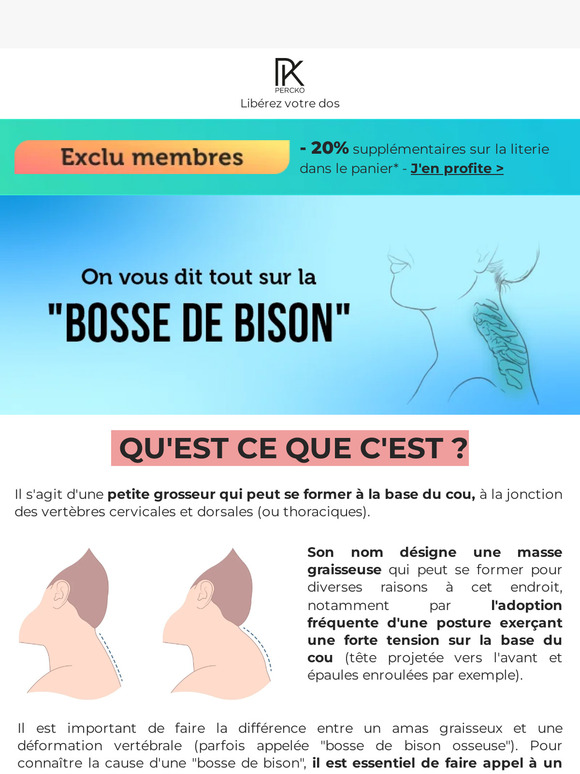 Percko France La bosse de bison Que faire ? Milled