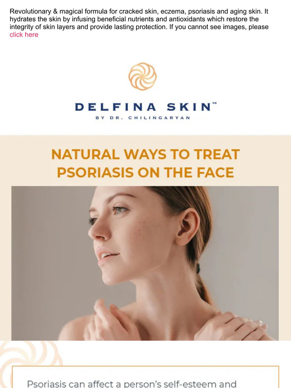 Natural Ways To Treat Psoriasis on the Face