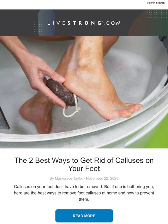The Best Ways to Get Rid of Calluses on Your Feet