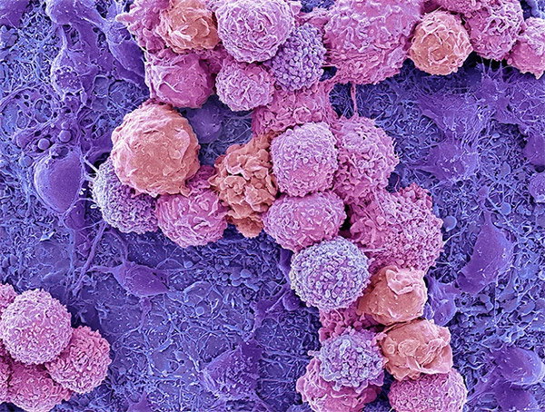 In this electron microscopy image, cells appear as fuzzy pink and orange spheres on a purple background.