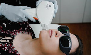 Laser Hair Removal