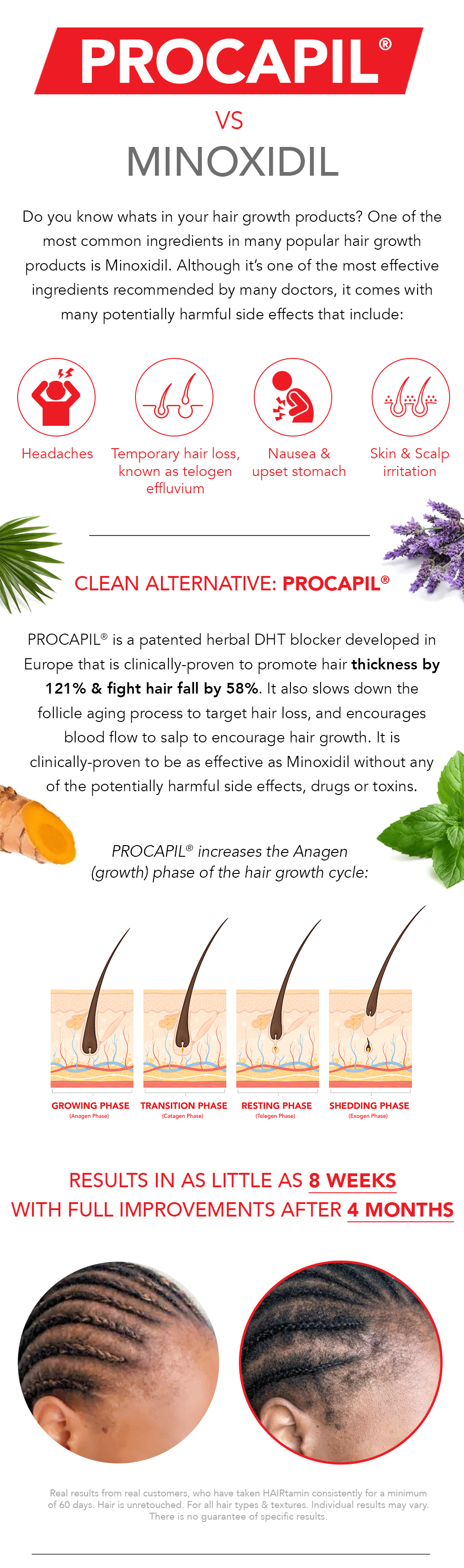 Hairtamin: PROCAPIL® 🆚 Minoxidil | Milled