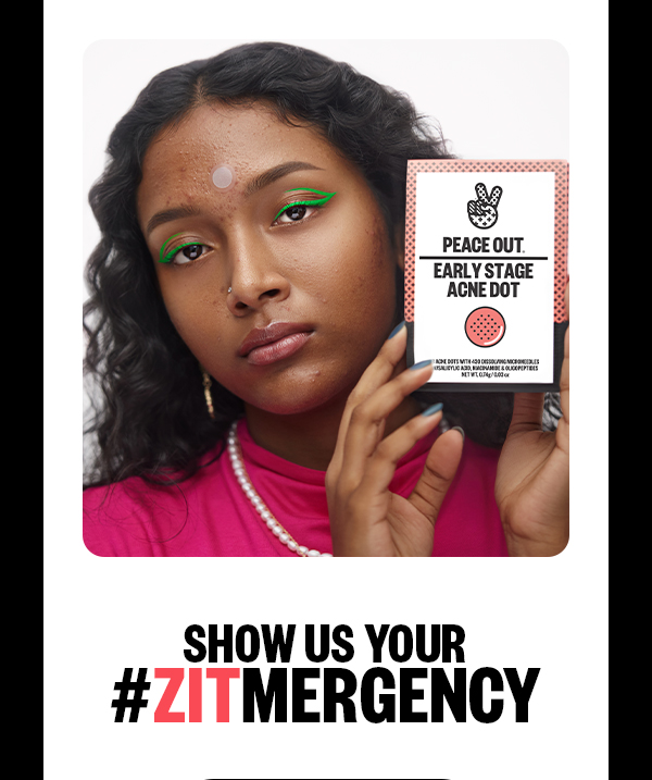 Model holding Early Stage Acne Dot. Show us your #zitmergency