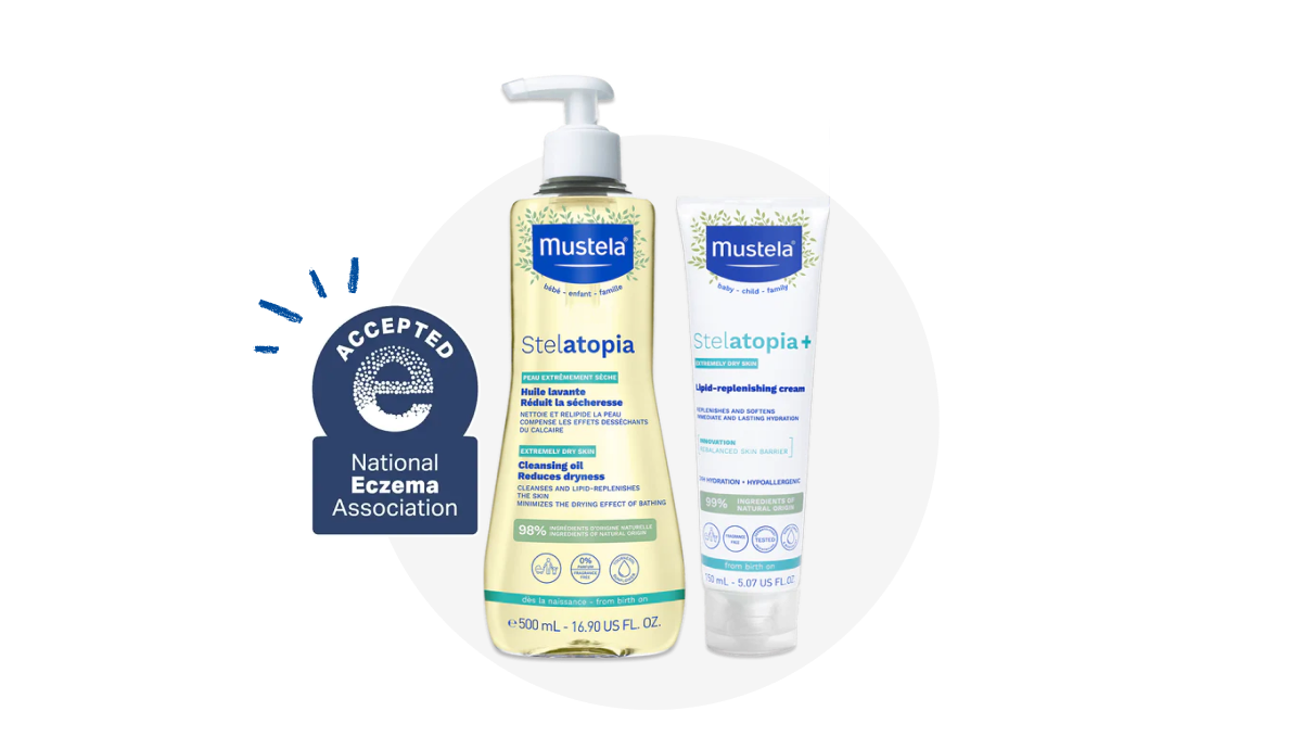 The Mustela Eczema-Prone Essential Set contains the Stelatopia Cleansing Oil and Stelatopia+ Lipid-Replenishing Cream.
