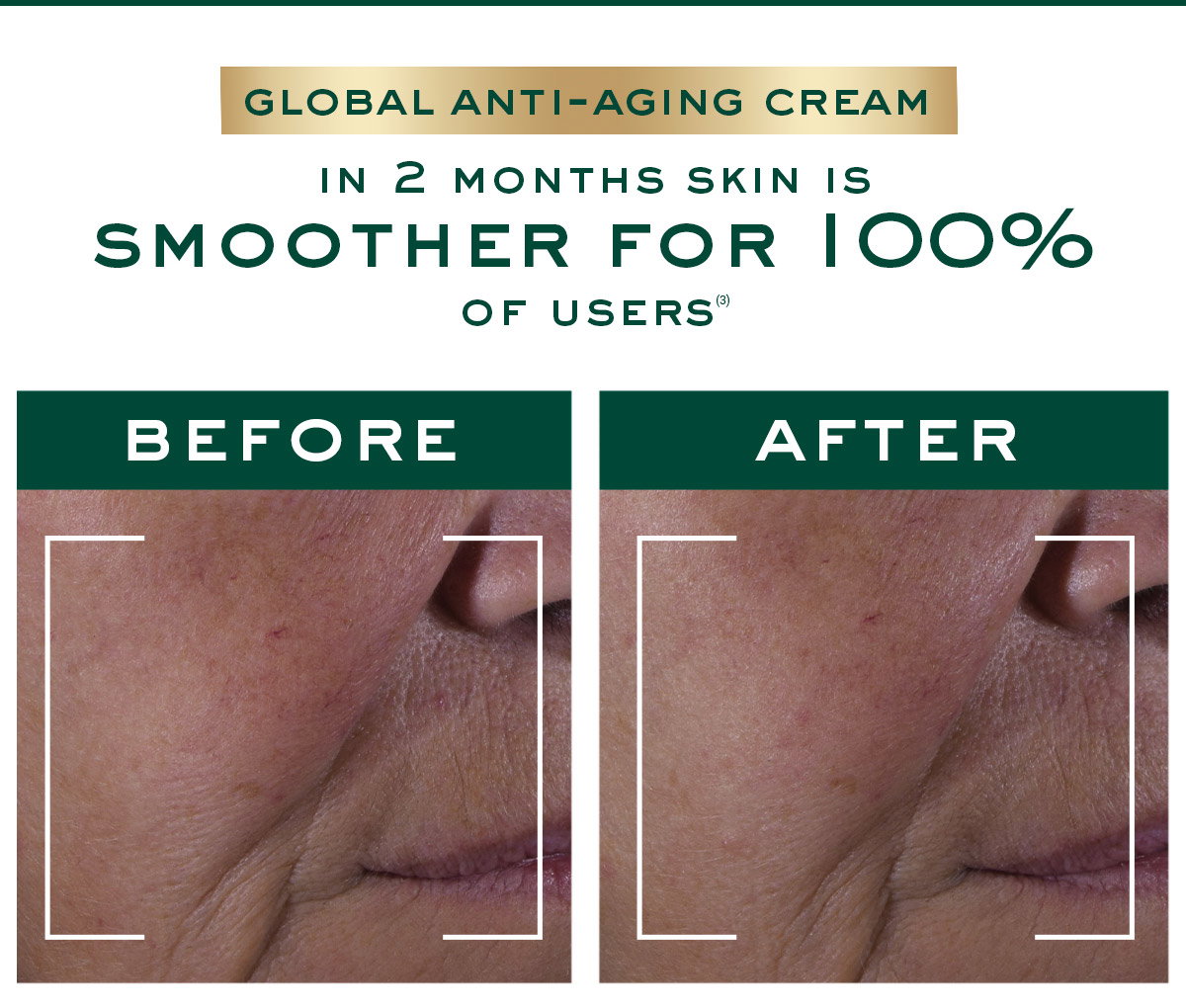 BEFORE/AFTER In 2 months, skin is smoother for 100% of users(3).Global Anti-Aging Cream