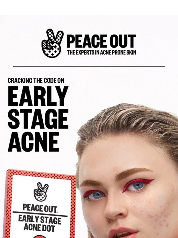 📩 Early-Stage Acne: Do You Know What to Look For?