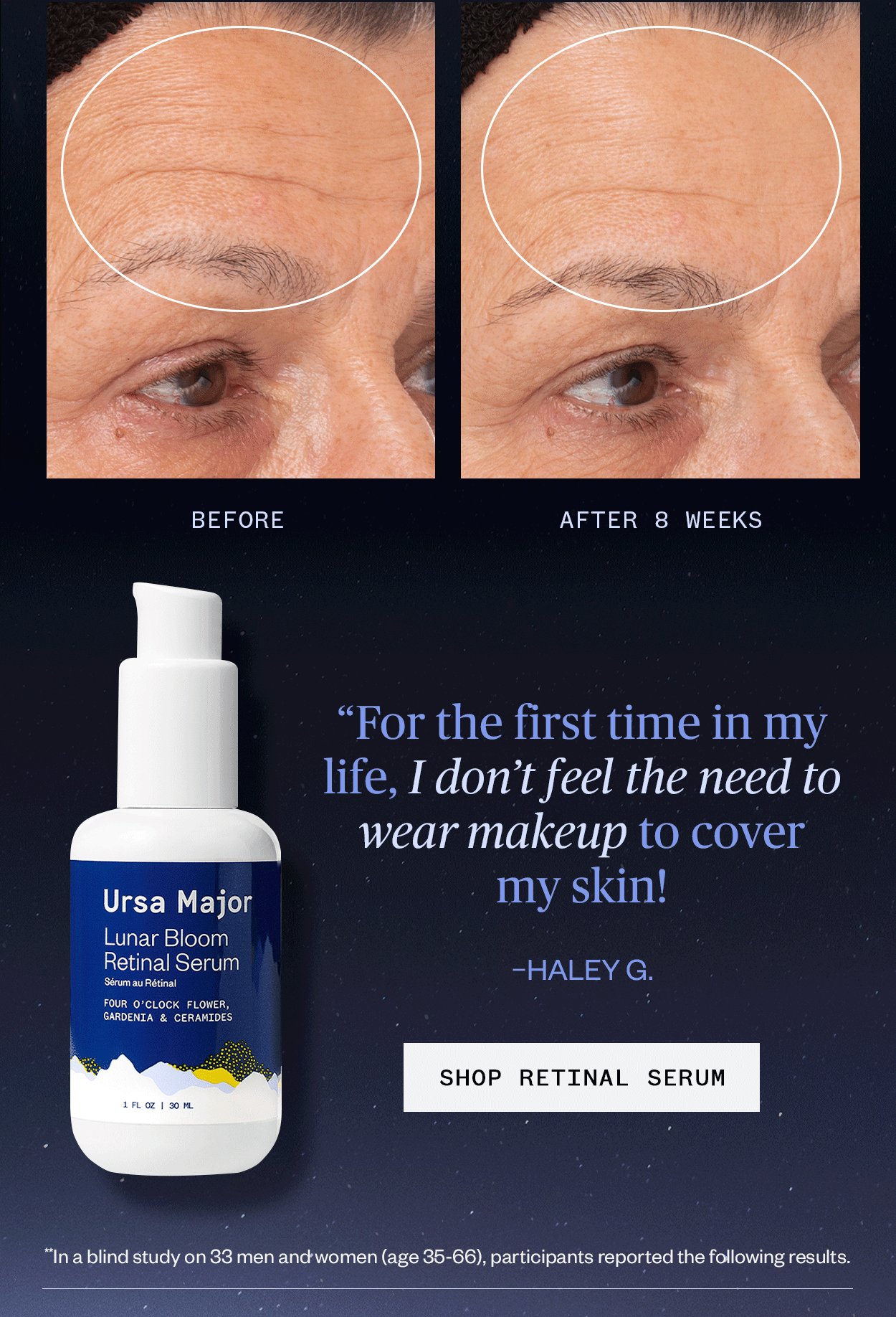 Ursa Major Results you can 👀 Milled