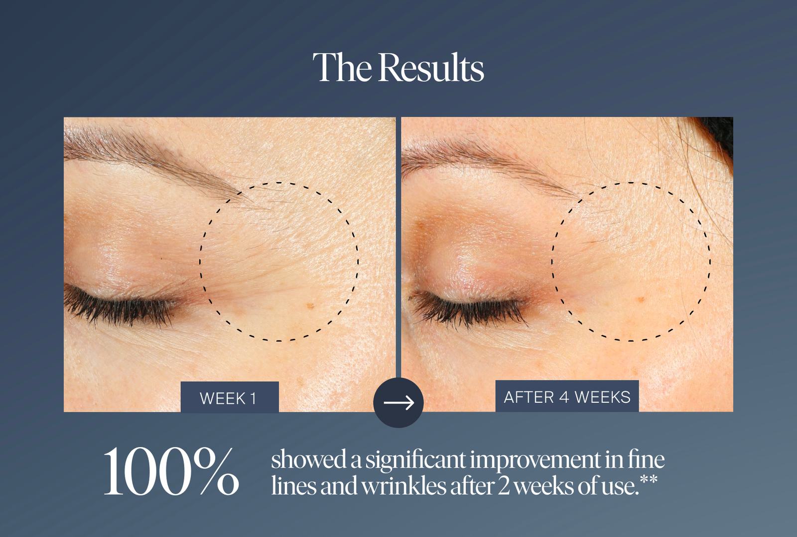 100% showed a significant improvement in fine lines and wrinkles after 2 weeks of use.**