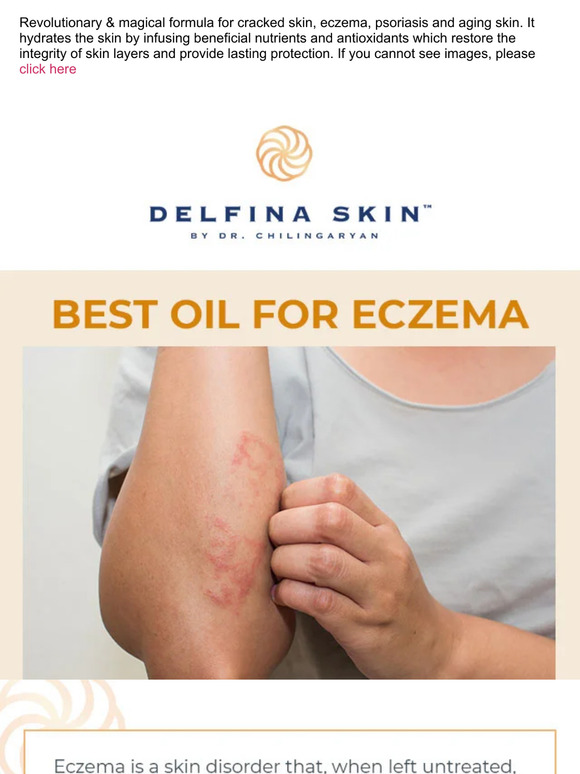 Best Oil For Eczema 😍