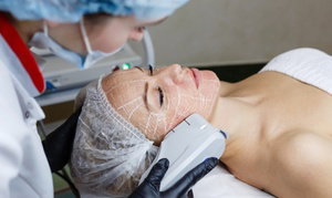 Up to 46% Off on Ultherapy / Ultrasonic Facial at Glam-Amor Skin LLC
