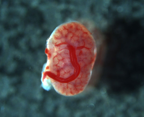 Pink cluster of cells in an oval shape with red blood vessels running up the front. Cells appear to be hovering against a dark background