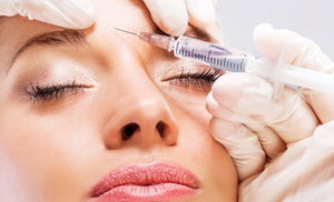 Xeomin or Radiesse Injections Xeomin or Radiesse Injections