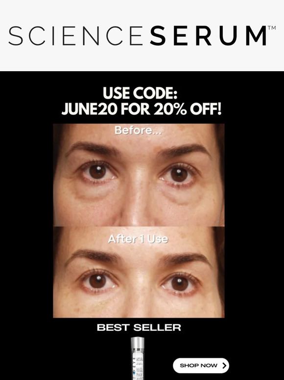 🚨TIGHTEYE SALE + FREE GIFT! 🚨