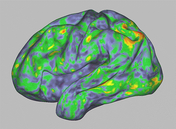 Animated heat map of an individual’s brain activity before, during and after psilocybin has been consumed.