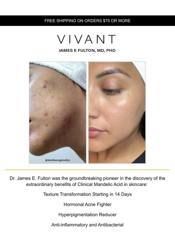 14 Days to Change your Texture