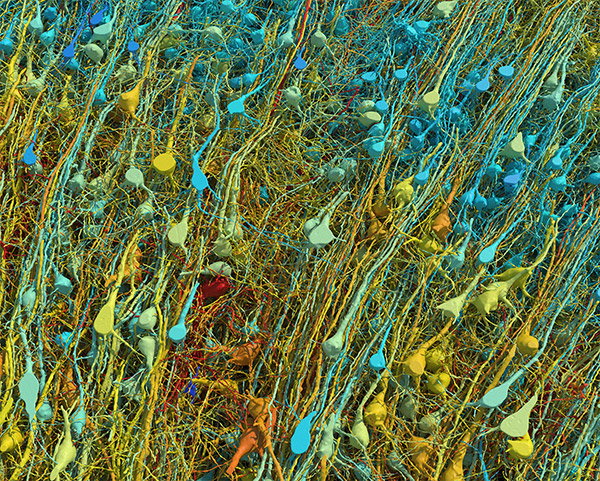 A sea of filaments and cells, coloured in a range of hues from red to cool blue.