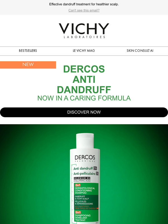 Say Goodbye to Stubborn Dandruff