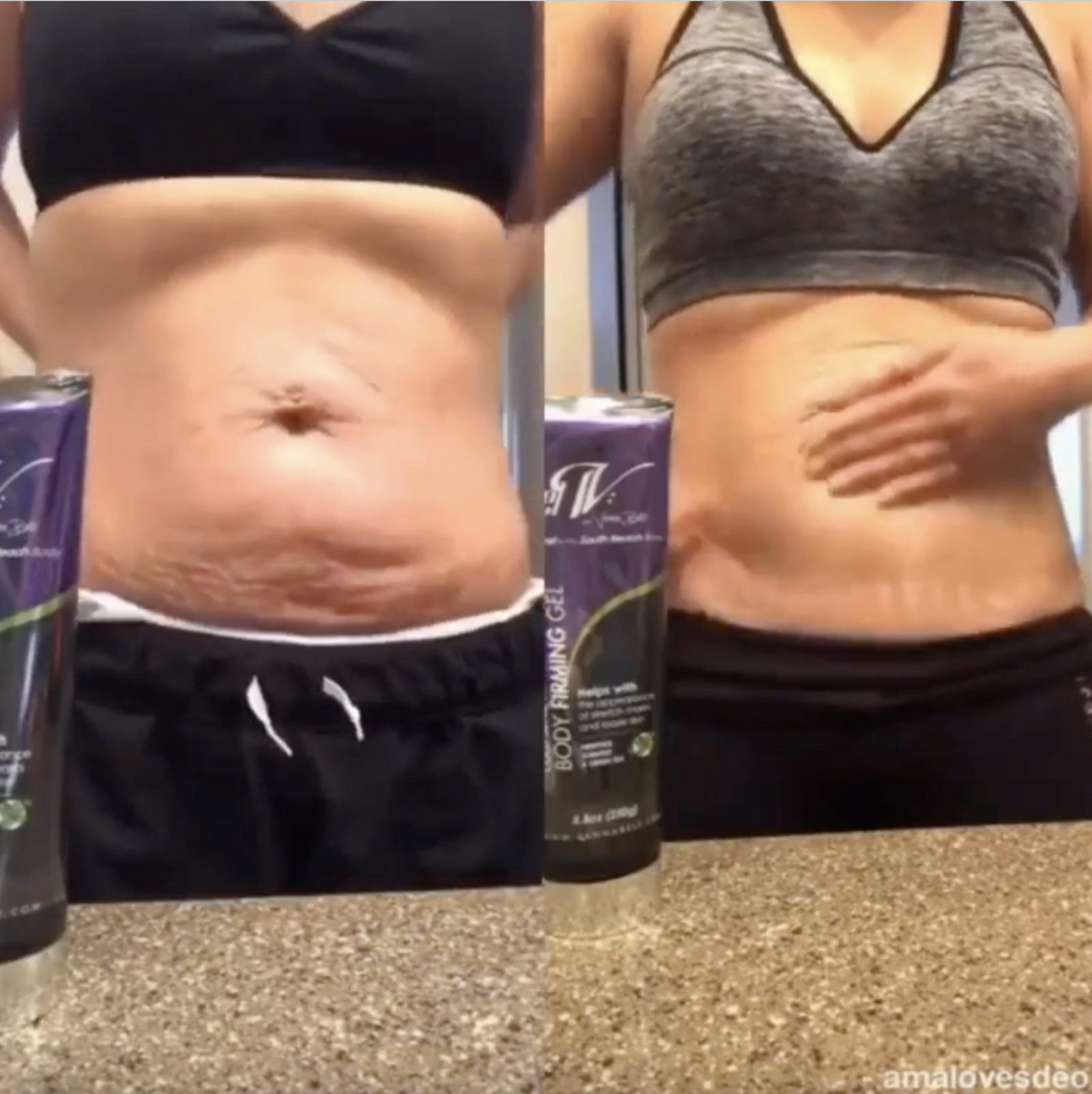 Terrific V Tight Gel Before And After Pictures Images