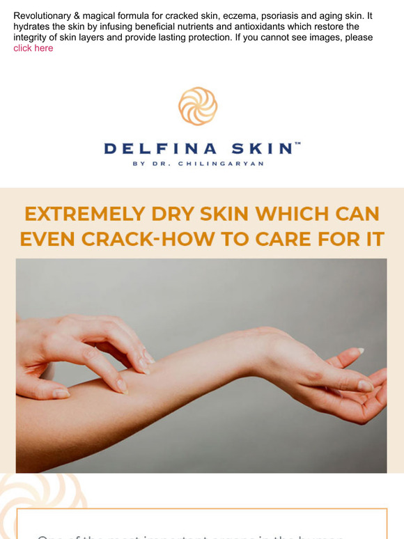 Extremely Dry Skin Which Can Even Crack-How To Care For It