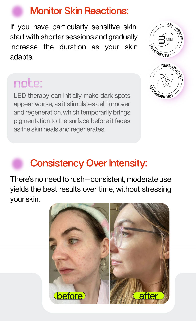 LED Esthetics LED Light Therapy Your Guide to Safe and Radiant Skin