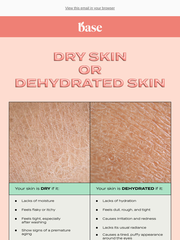 1–10 berapa kadar hidrasi kulit kamu? 💦