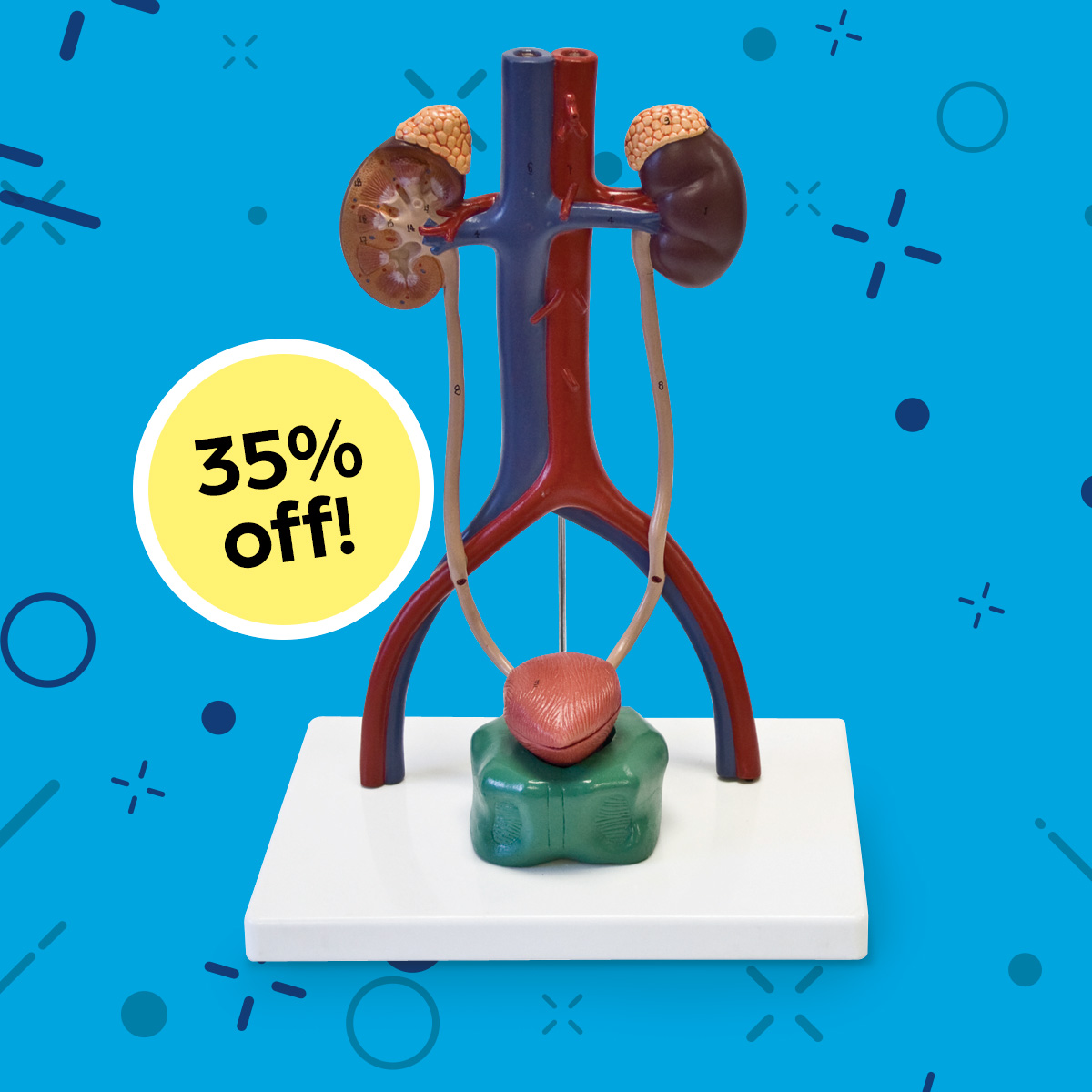 Urinary System Model