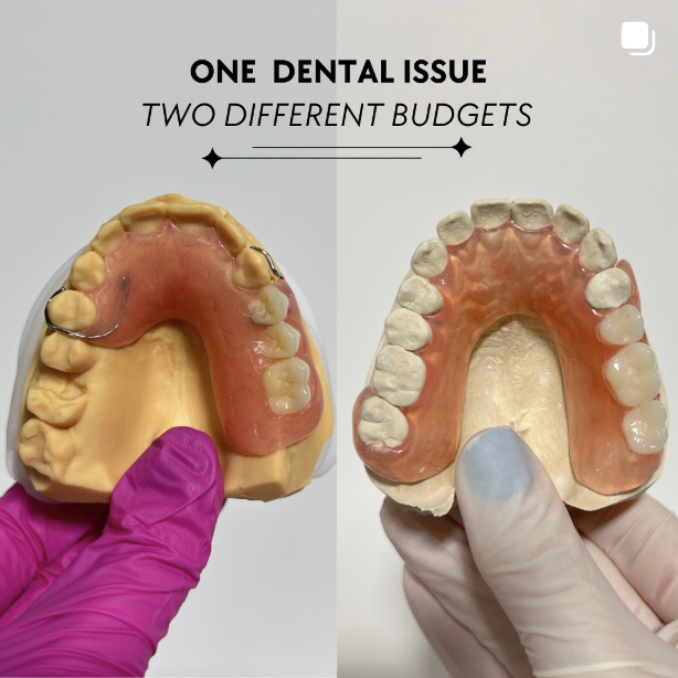 Dentures for missing back teeth 