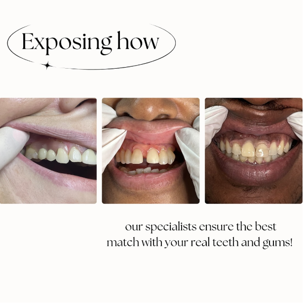 Match with your real teeth and gums 