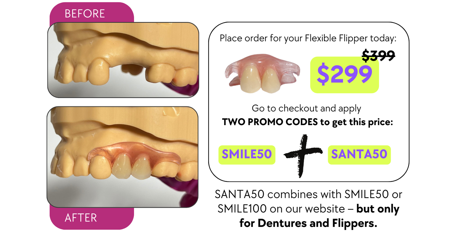 Smile Boutique NY Flexible Flipper