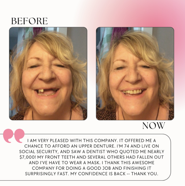 Before and After Flexible Denture