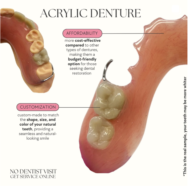 Acrylic Denture