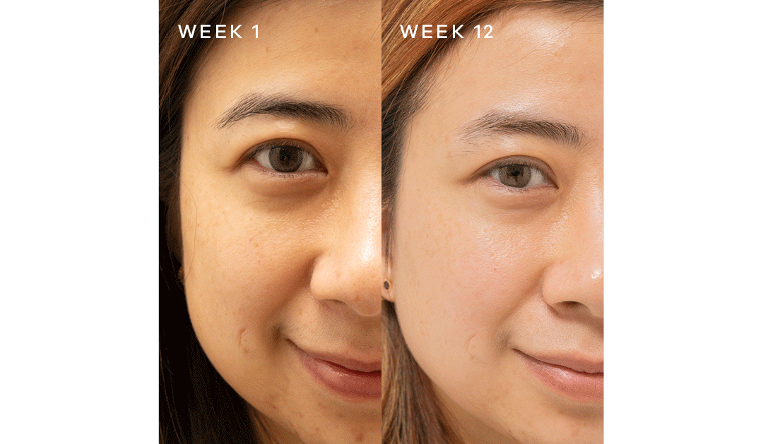 Before & After