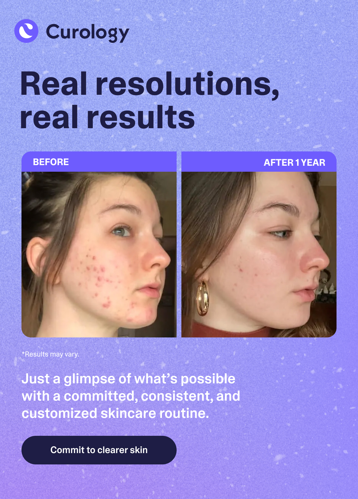 Commit to better skin