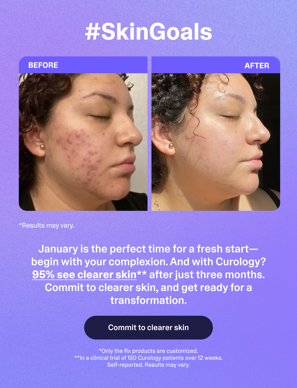 Skingoals. Commit to clearer skin. 