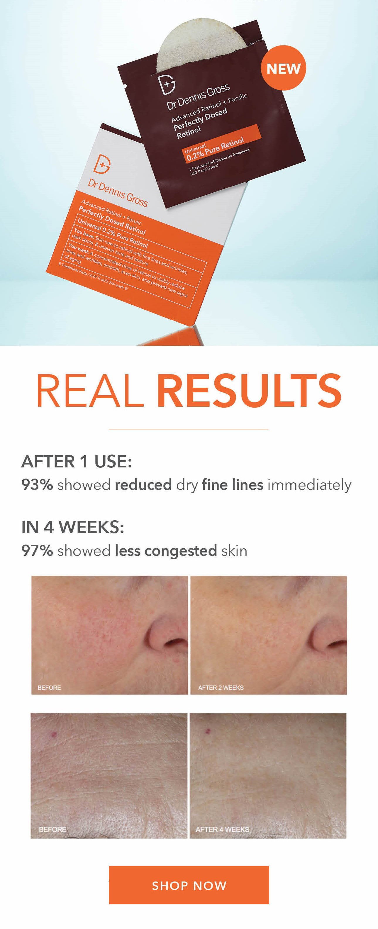 NEW! Perfectly Dosed Retinol Treatments