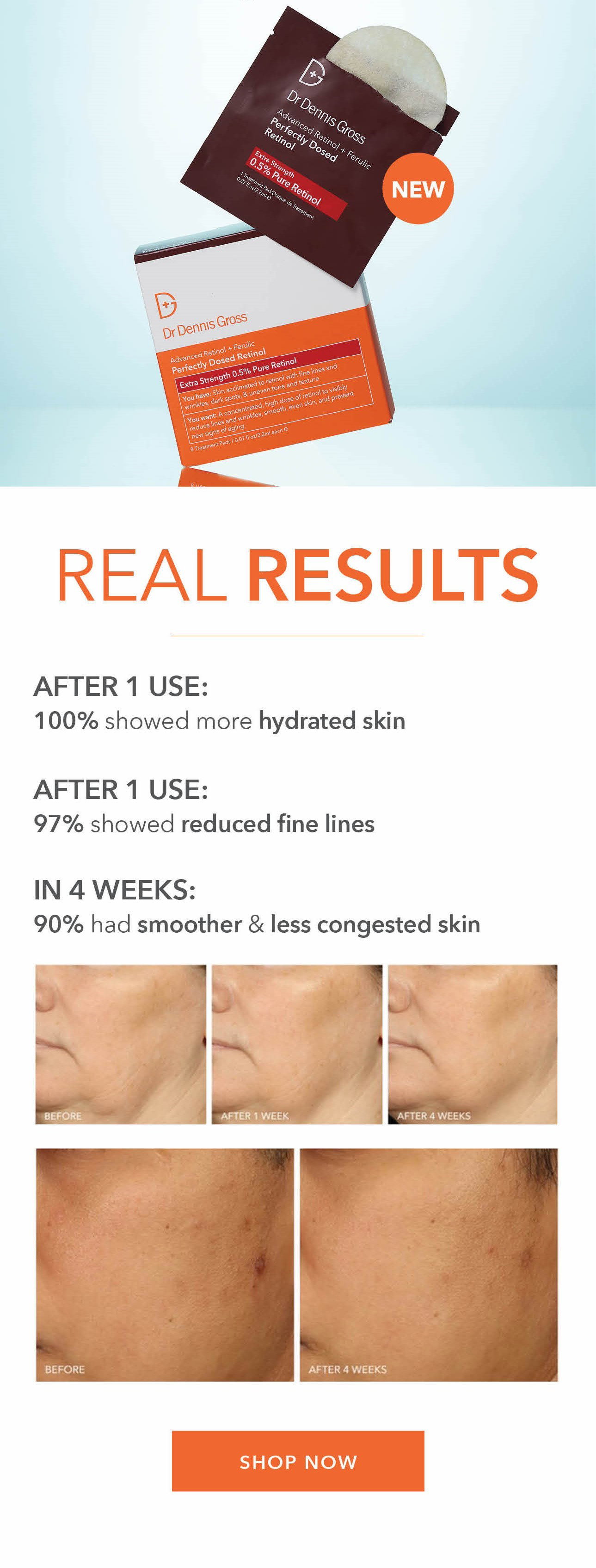 NEW! Perfectly Dosed Retinol Treatments